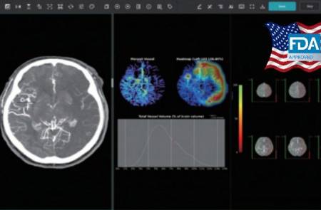 제이엘케이, 뇌졸중 솔루션 FDA 승인… 미국 진출 가속화